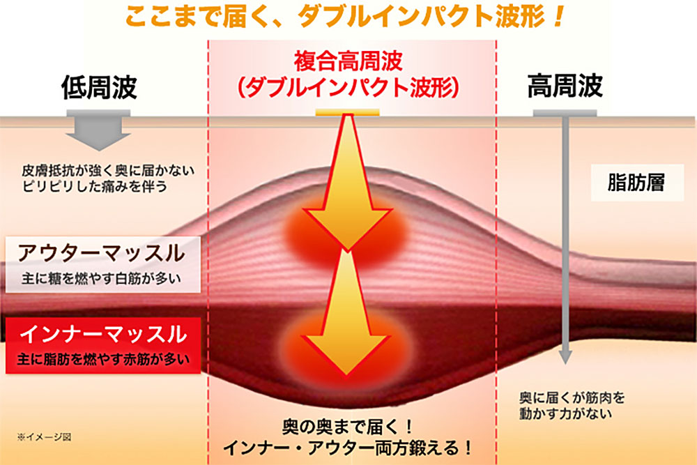 複合高周波（ダブルインパクト波形）